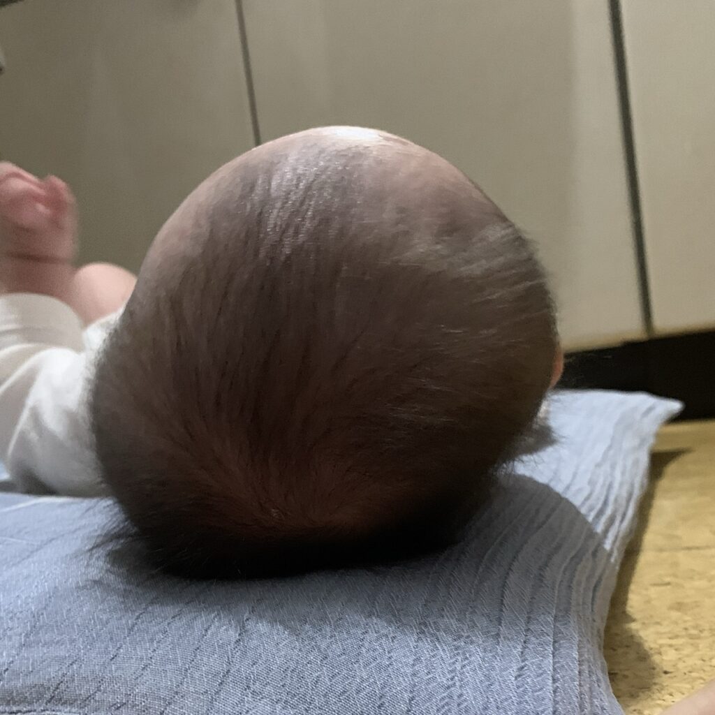 生後三ヶ月の頭の形